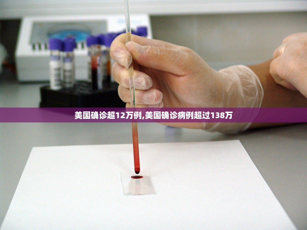 美国确诊超12万例,美国确诊病例超过138万 美国确诊超12万例,美国确诊病例超过138万